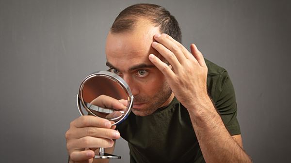 Учёные назвали привычку, которая провоцирует облысение у мужчин