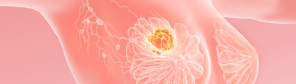 FDA одобрило препарат от Lilly для лечения прогрессирующего рака молочной железы