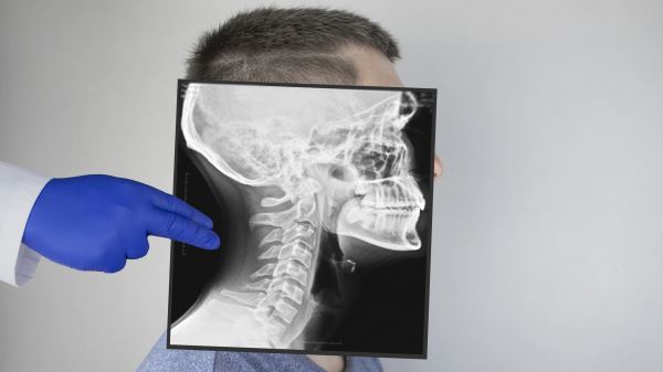 Невролог назвала четыре бесполезных обследования при головных болях