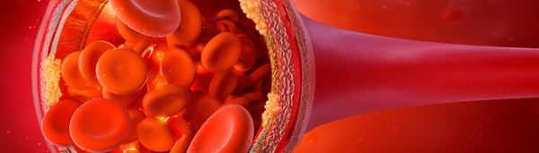 Гиполипидемический препарат от MSD успешно прошел очередное исследование