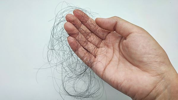 «Оземпик» вызывает облысение — исследование