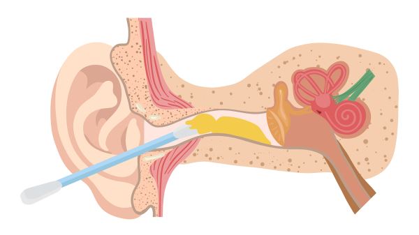 Лор рассказал, чем опасны ушные палочки и фитосвечи